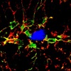 Image shows microglia surrounding an amyloid plaque in the brain of an Alzheimer’s disease mouse model.