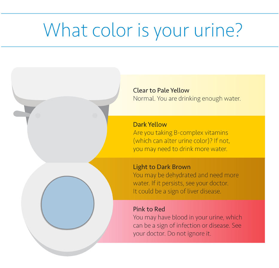 Infographic on urine colors